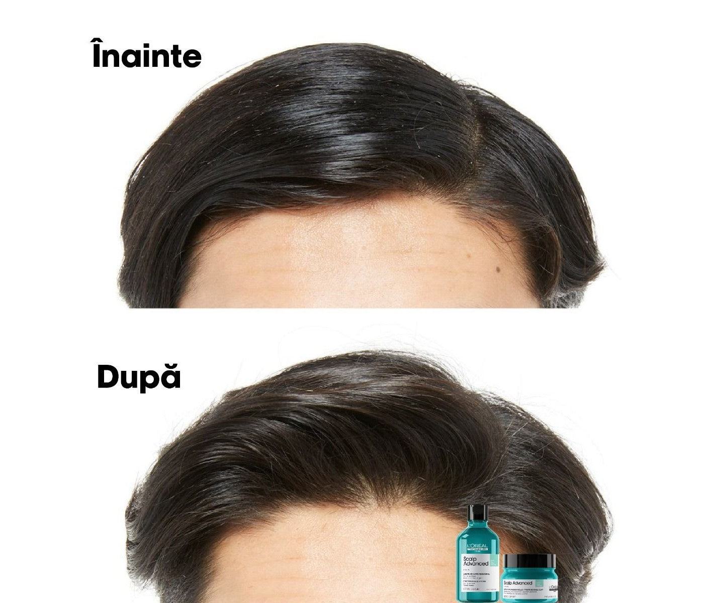 L'Oreal Professionnel Serie Expert Scalp Advanced 2 az 1-ben sampon és maszk zsíros fejbőrre agyaggal, utazóméret 75ml