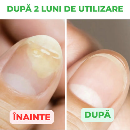 StraDerm Active Care – Gombaellenes és Antibakteriális Kezelés Körmökre és Bőrre 30ml