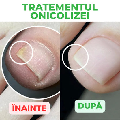 StraDerm Active Care – Gombaellenes és Antibakteriális Kezelés Körmökre és Bőrre 30ml