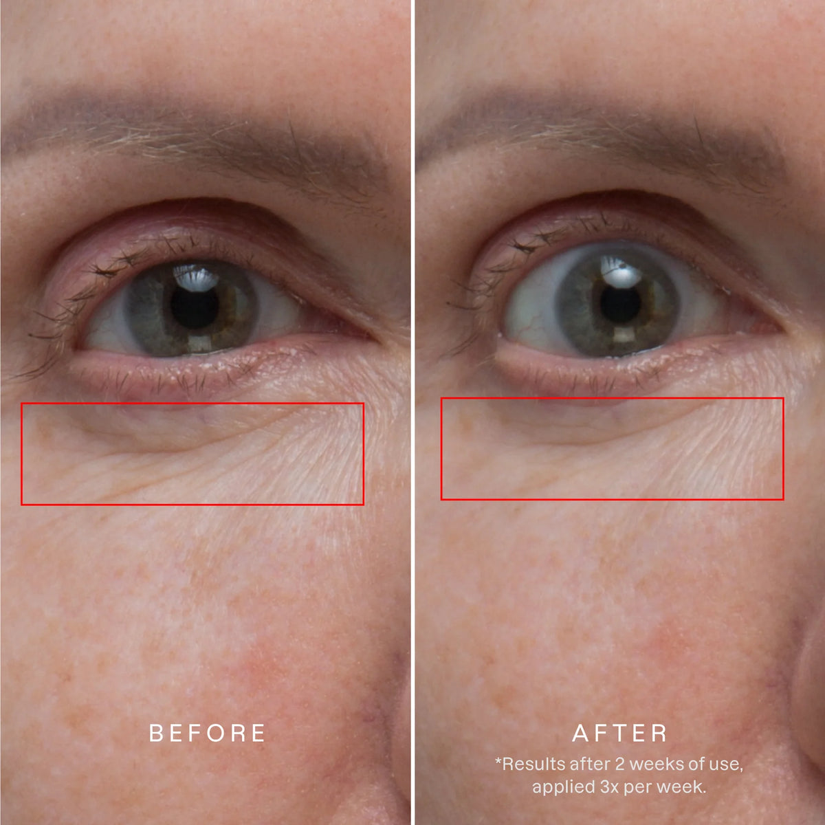 Karuna Age Rewind Microneedle Patches, plasturi cu microace, retinol și peptide pentru riduri