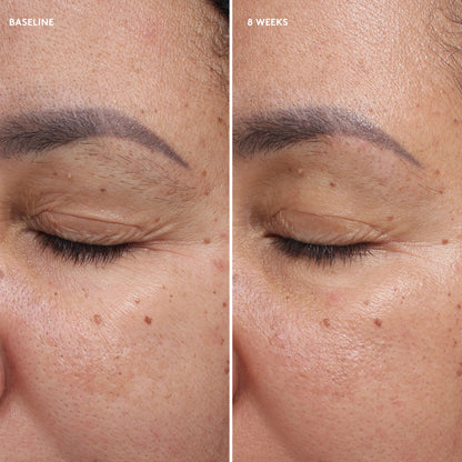Colorescience Total Eye feszesítő és regeneráló szemkörnyékápoló krém 18ml