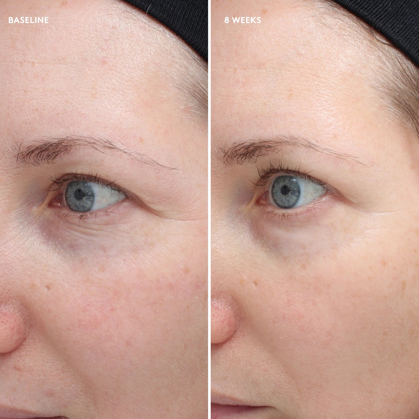 Colorescience Total Eye feszesítő és regeneráló szemkörnyékápoló krém 18ml