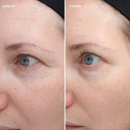 Colorescience Total Eye feszesítő és regeneráló szemkörnyékápoló krém 18ml