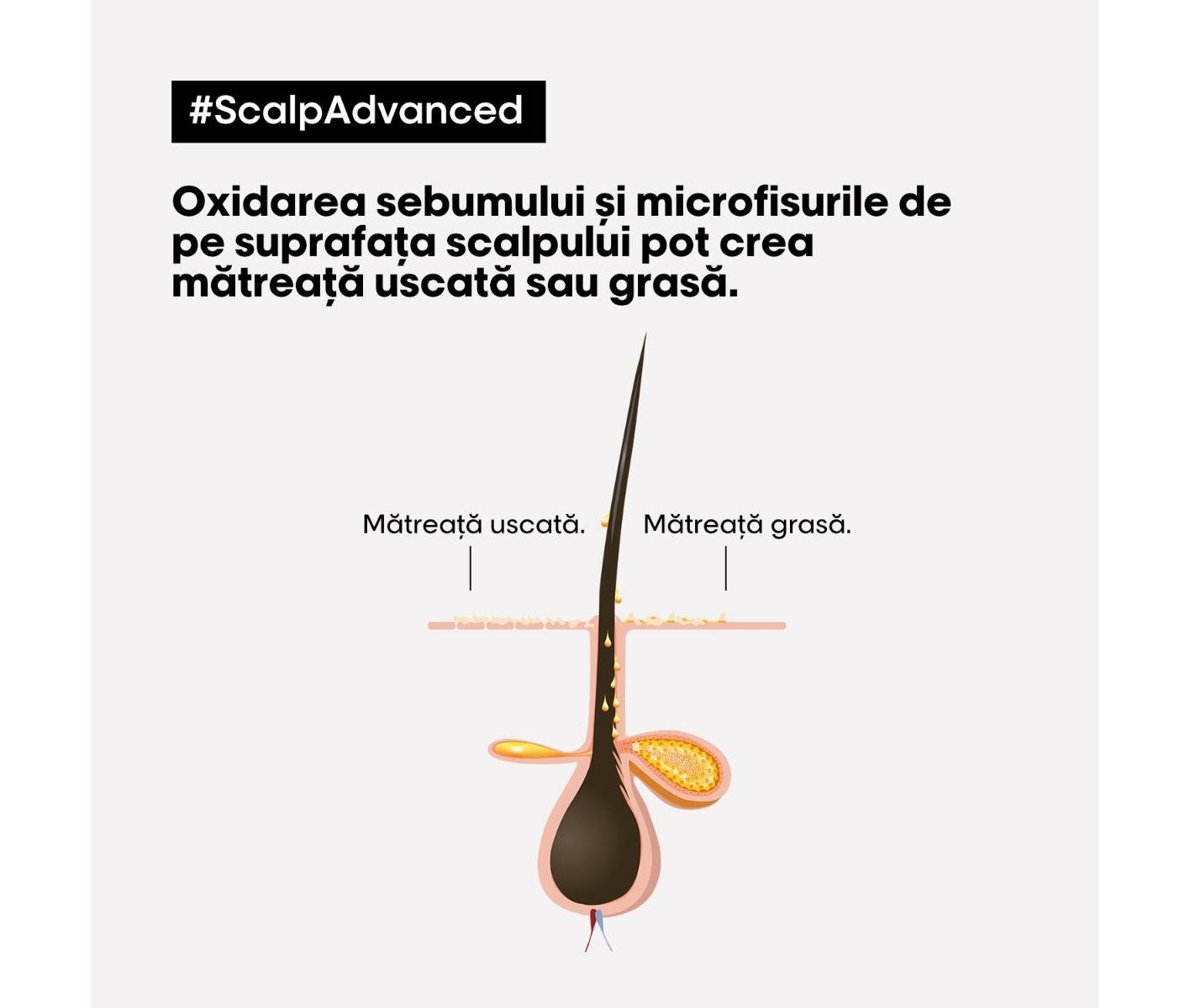 Korpaellenes sampon fejbőrre — L'Oréal Professionnel Scalp Advanced 300ml