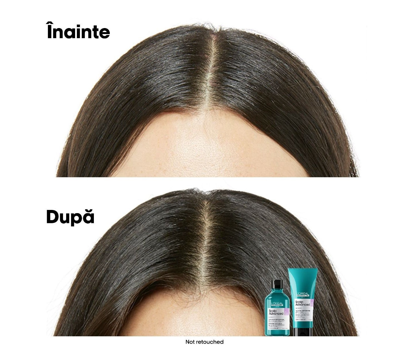 L'Oreal Professionnel Serie Expert Scalp Advanced sampon érzékeny fejbőrre niacinamiddal 300ml