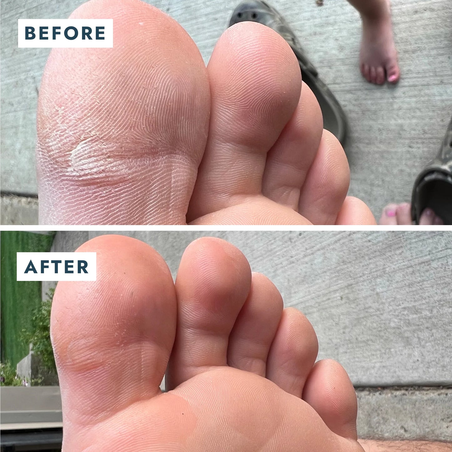 Sarokjavító duó, helyreállító balzsam + zokni Voesh Heel Repair Duo Mint