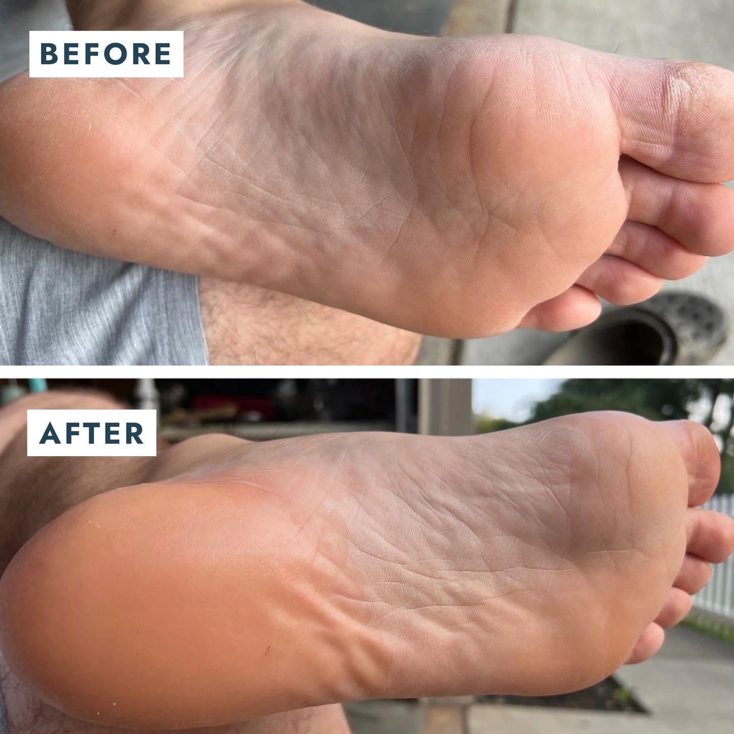 Sarokjavító duó, helyreállító balzsam + zokni Voesh Heel Repair Duo Mint