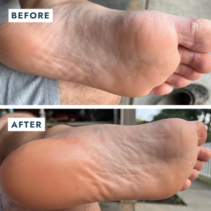 Sarokjavító duó, helyreállító balzsam + zokni Voesh Heel Repair Duo Mint